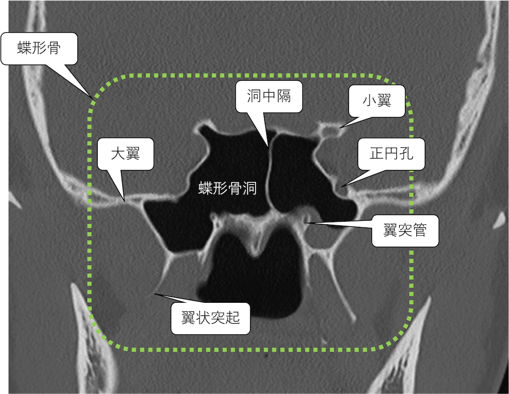 頭蓋底の構成骨